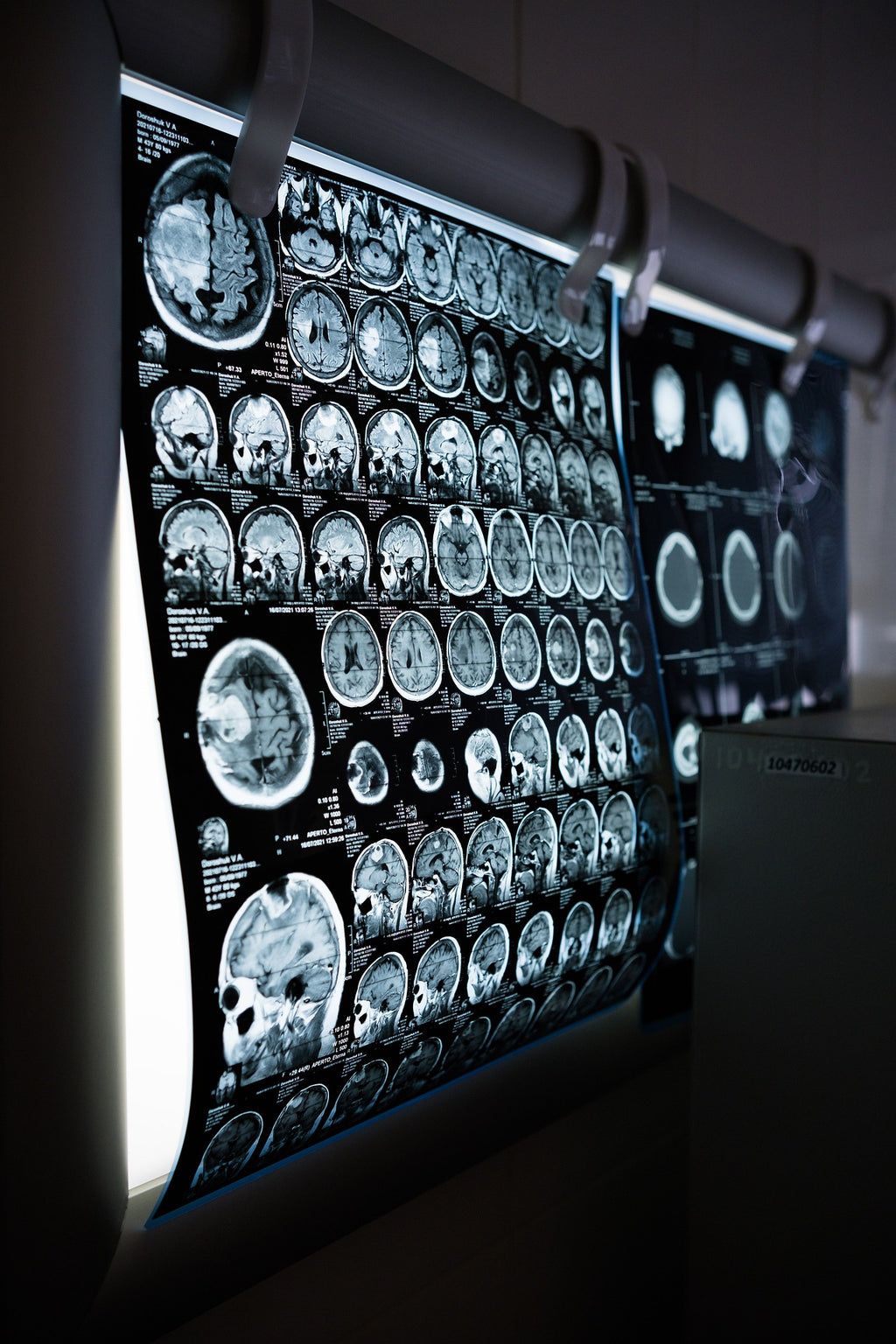 EFFECT OF MARIJUANA ON THE BRAIN